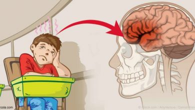تصویر از بررسی مغز کودکان با نقص توجه و بیش فعالی